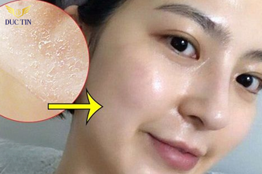 Peel da giá bao nhiêu rơi vào khoảng 250.000 - 500.000 cho một lần peel